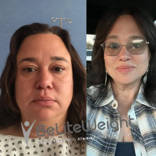 Davina G - 2 Year Update*